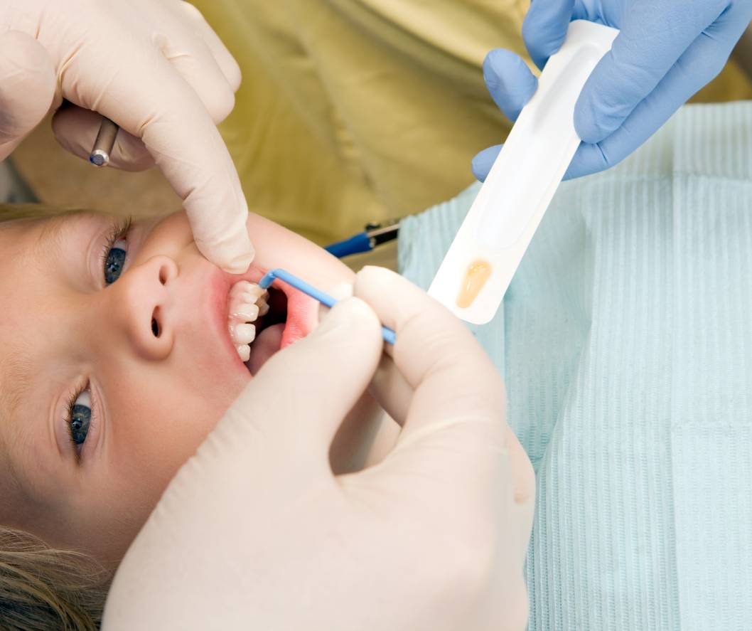 Our family dentist in Midlothian applying fluoride treatment to a young patient