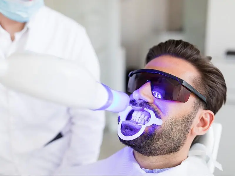 In Office teeth-whitening